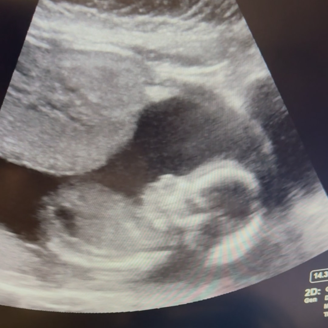 Photo shared by Brittany for their Babylist baby registry.