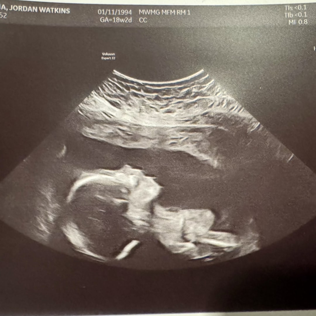 Photo shared by Jordan for their Babylist baby registry.