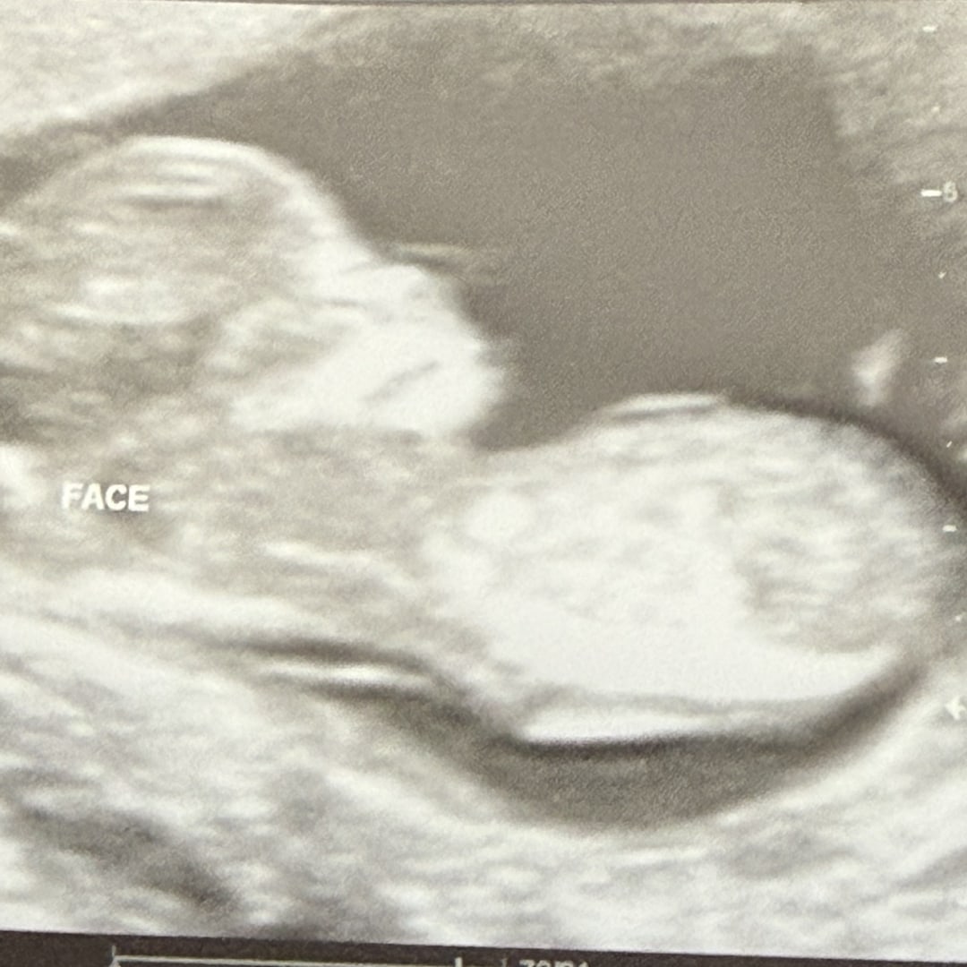 Photo shared by Samantha for their Babylist baby registry.