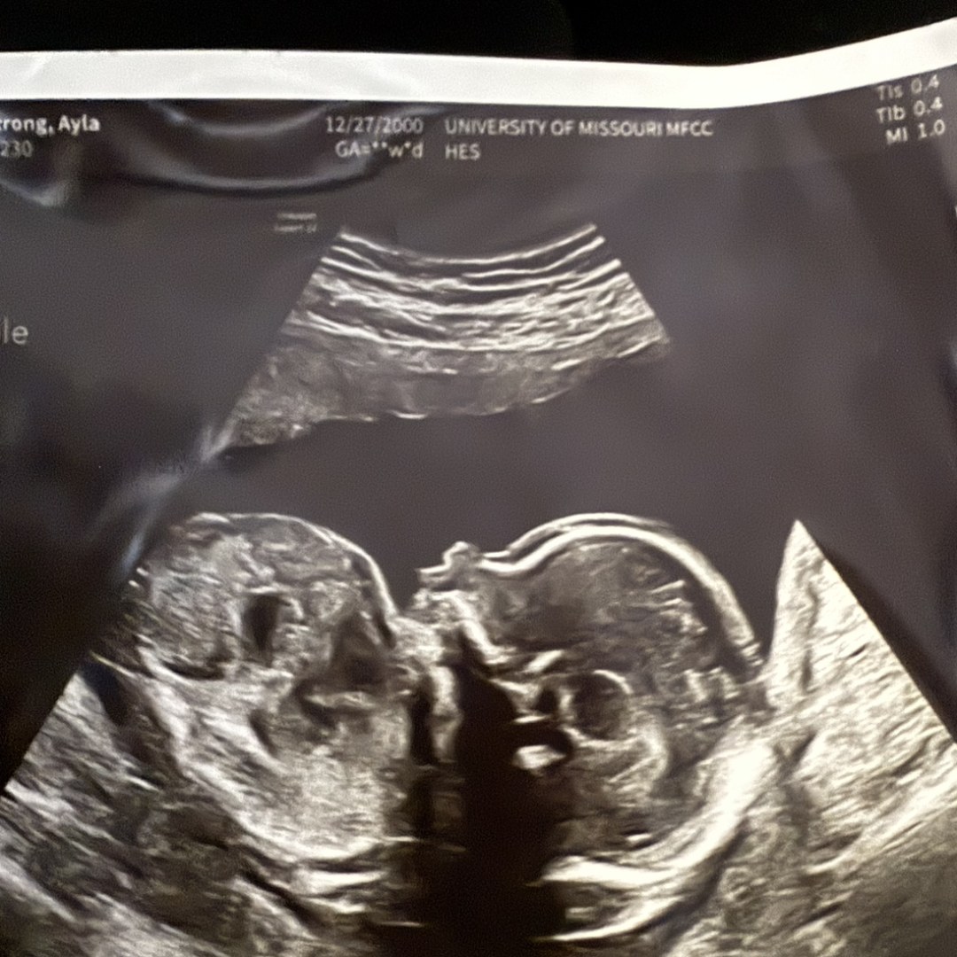 Photo shared by Ayla for their Babylist baby registry.