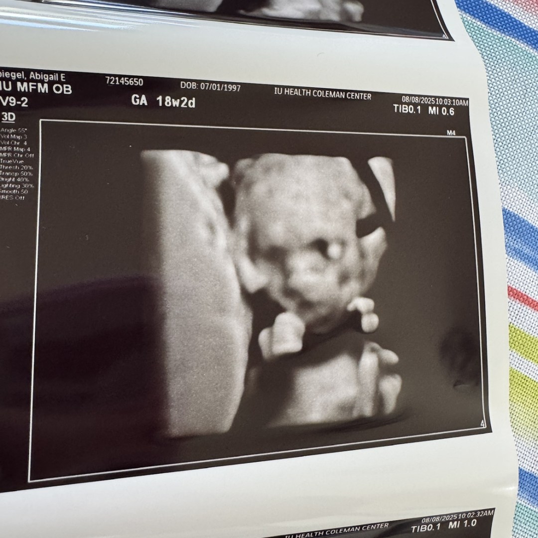 Photo shared by Abi for their Babylist baby registry.