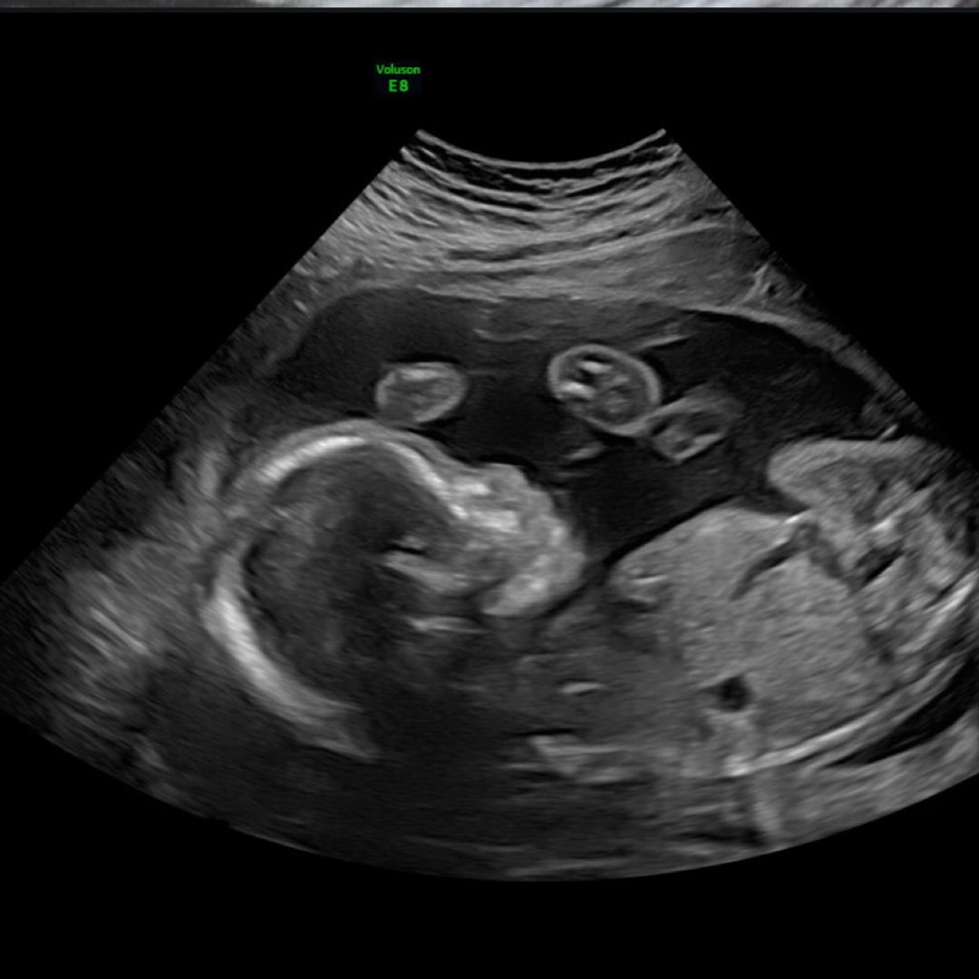 Photo shared by Gianii for their Babylist baby registry.