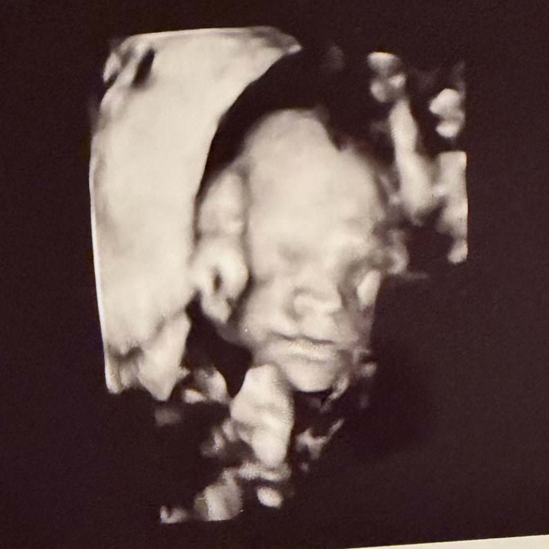 Photo shared by Kaitlyn for their Babylist baby registry.