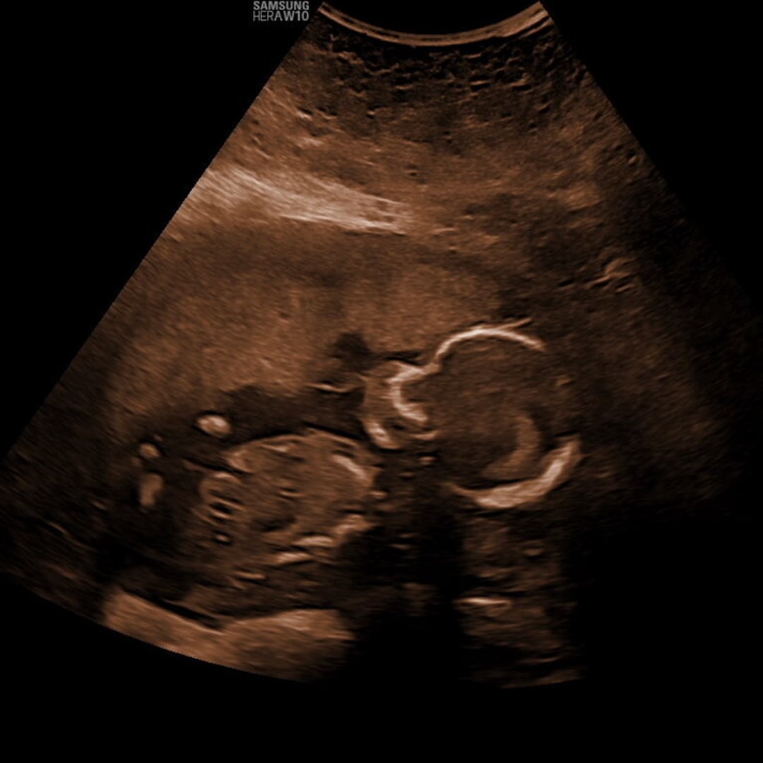 Photo shared by Erin for their Babylist baby registry.