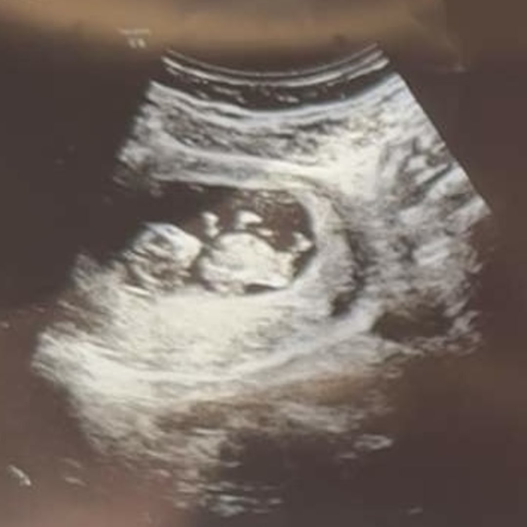 Photo shared by Sophia for their Babylist baby registry.