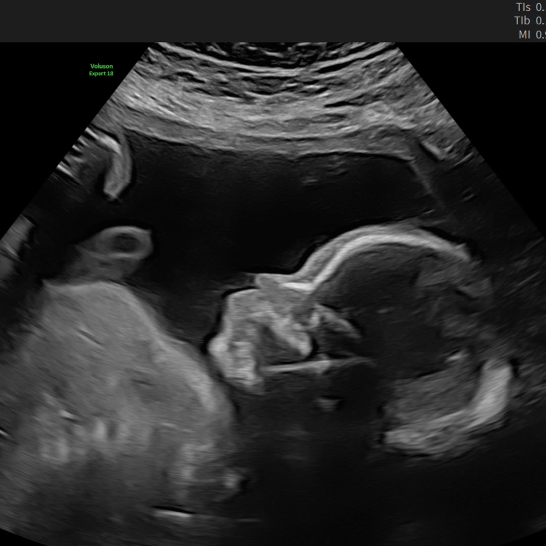 Photo shared by Gabriella for their Babylist baby registry.