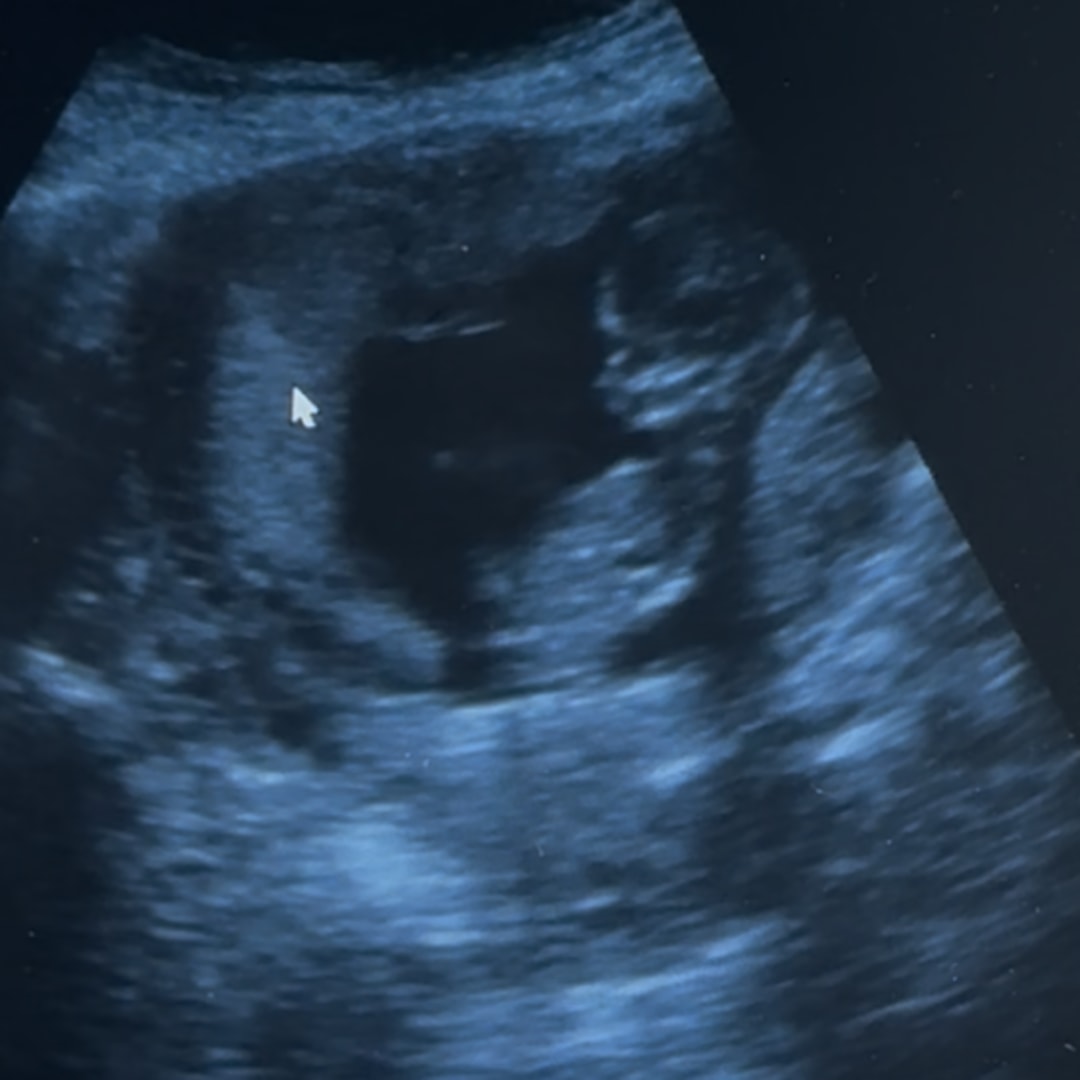 Photo shared by Lorena for their Babylist baby registry.