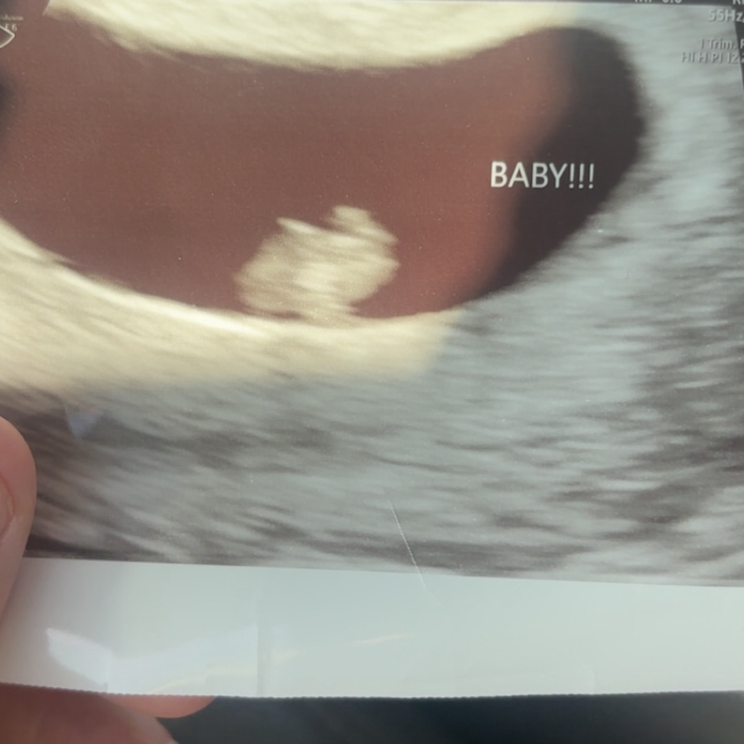 Photo shared by Brieanna for their Babylist baby registry.