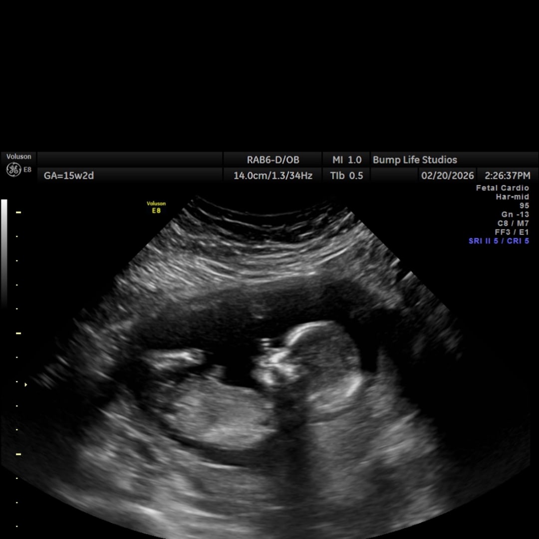 Photo shared by Leslie for their Babylist baby registry.