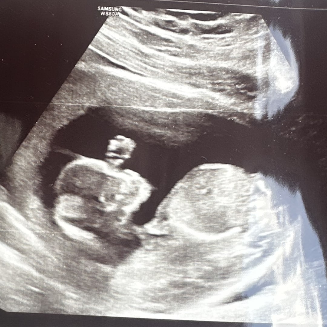 Photo shared by Brianna for their Babylist baby registry.