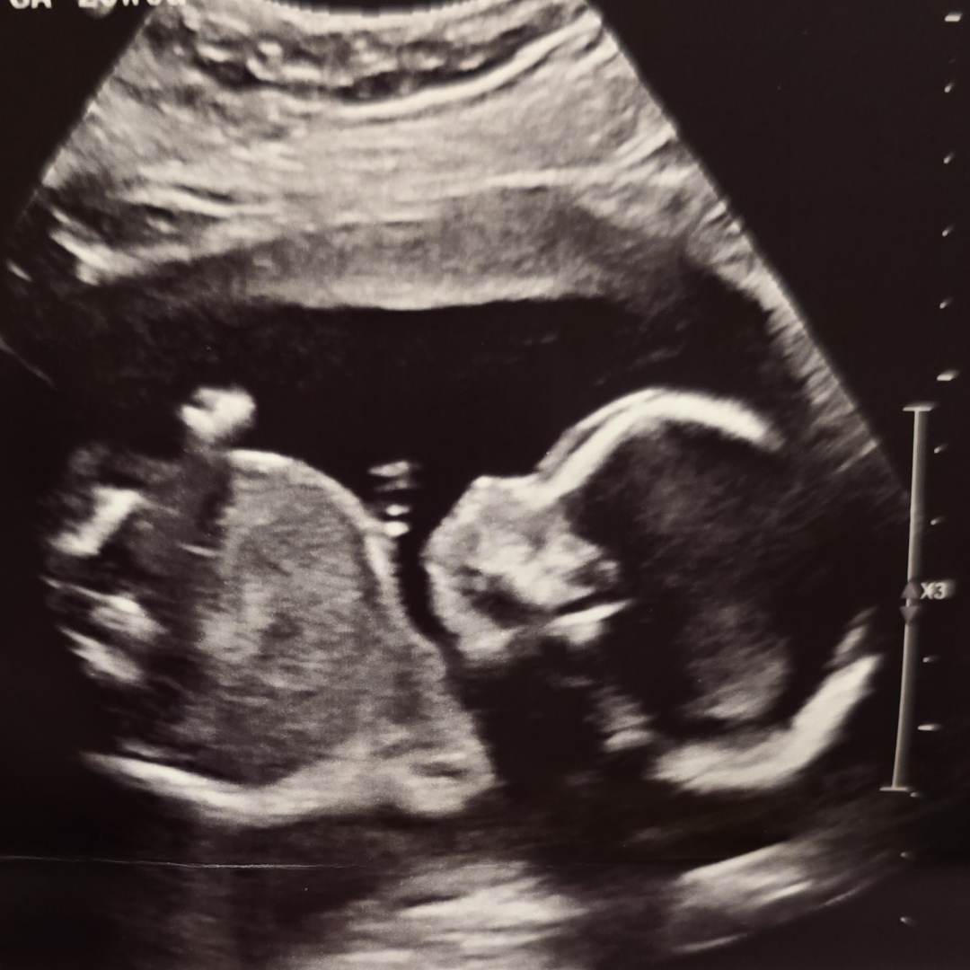 Photo shared by Amelia for their Babylist baby registry.