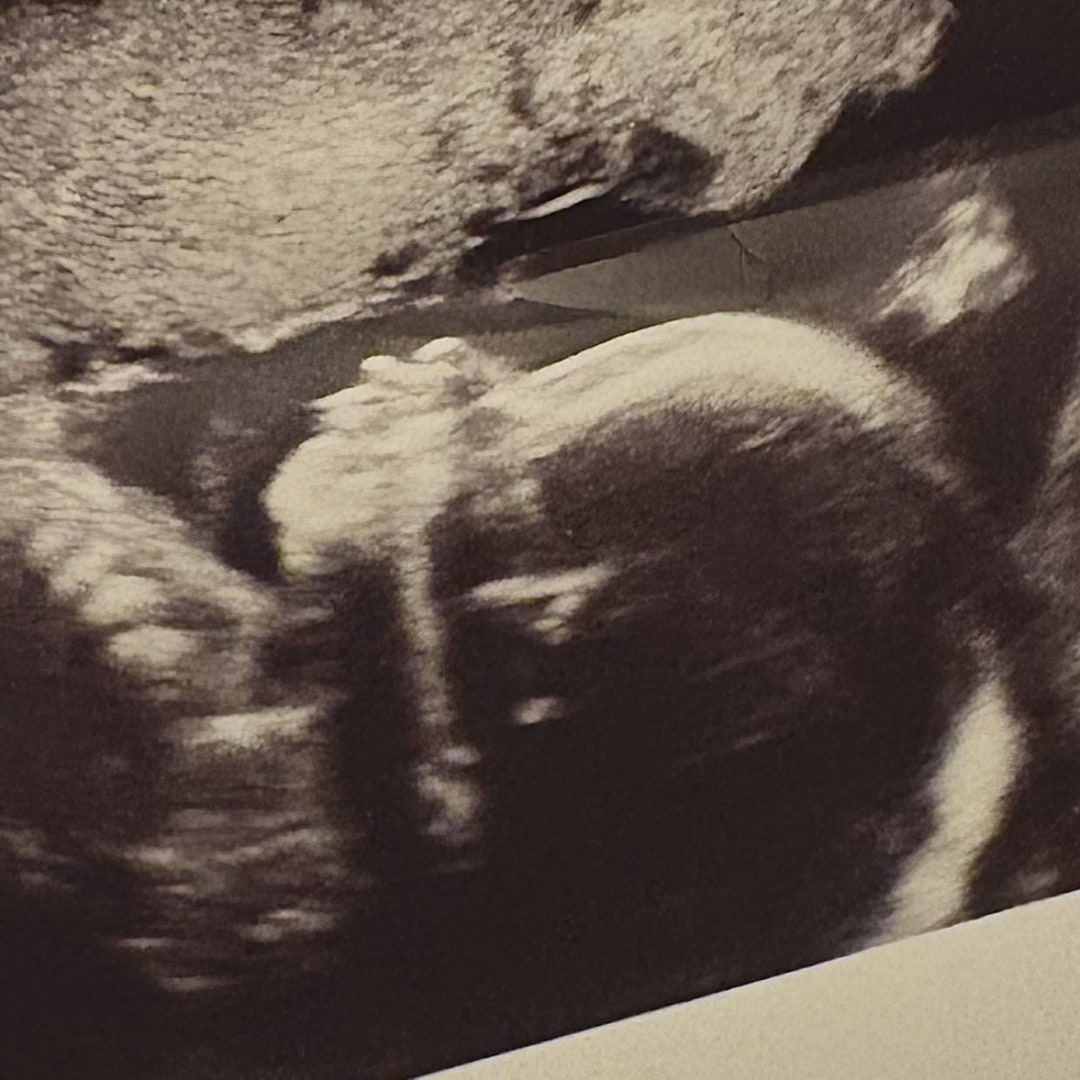 Photo shared by Lydia for their Babylist baby registry.
