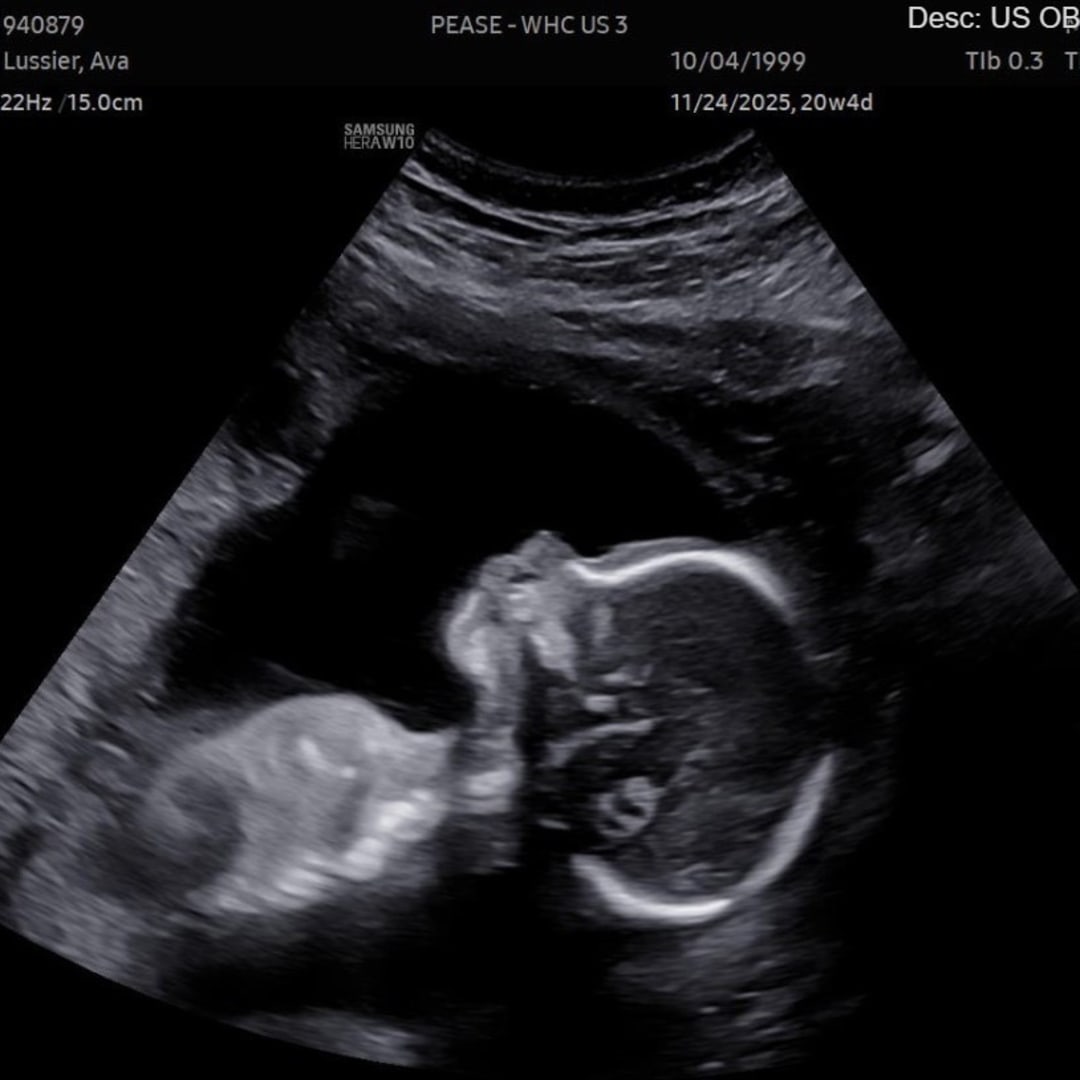 Photo shared by Ava for their Babylist baby registry.