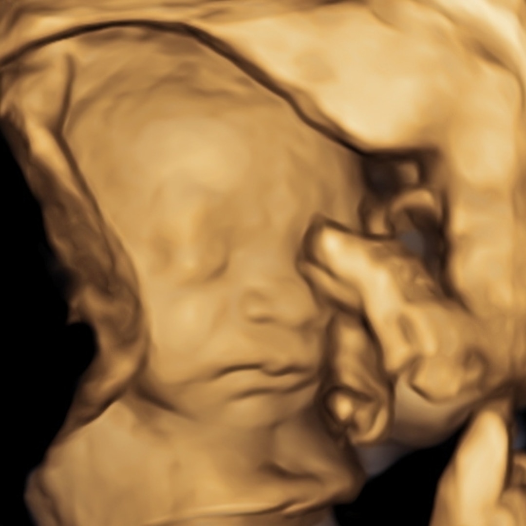 Photo shared by Virginia for their Babylist baby registry.