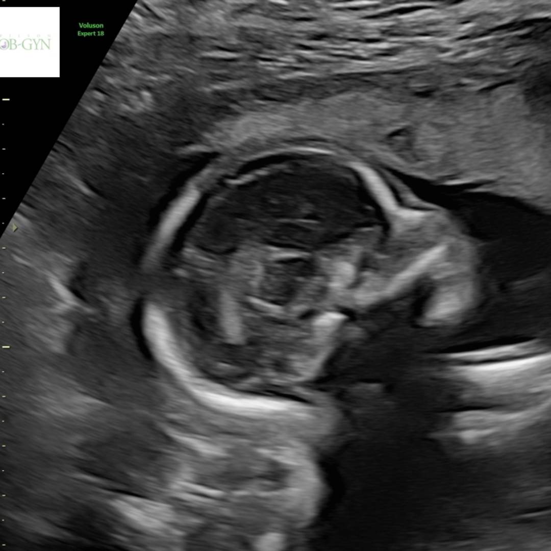 Photo shared by A'Sierra for their Babylist baby registry.