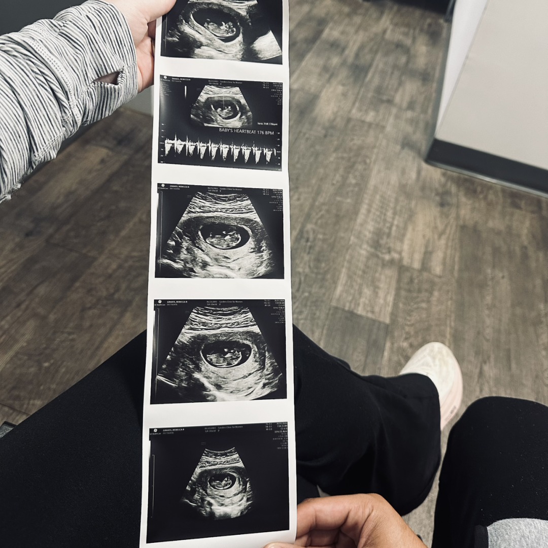 Photo shared by Rebecca for their Babylist baby registry.
