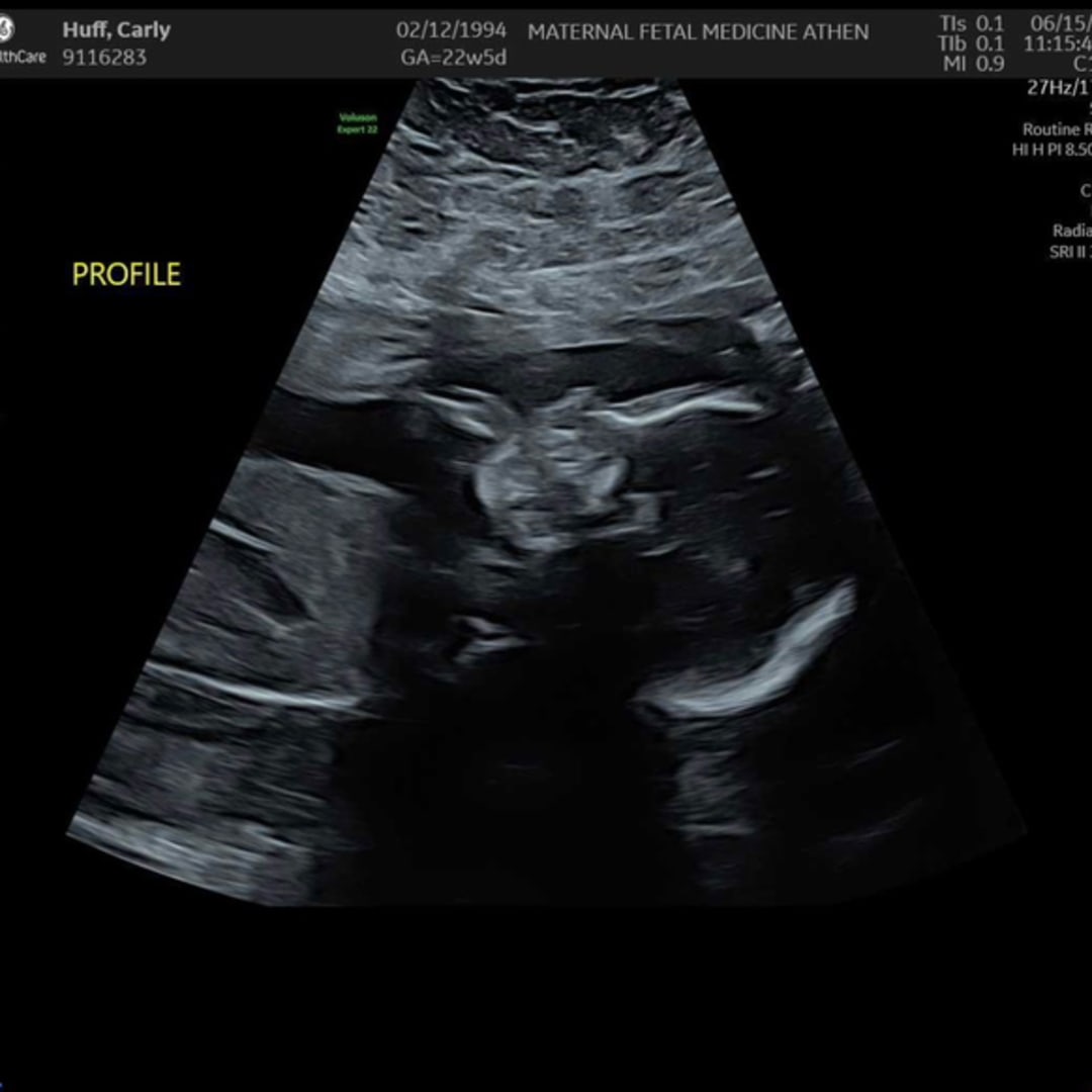 Photo shared by Carly for their Babylist baby registry.