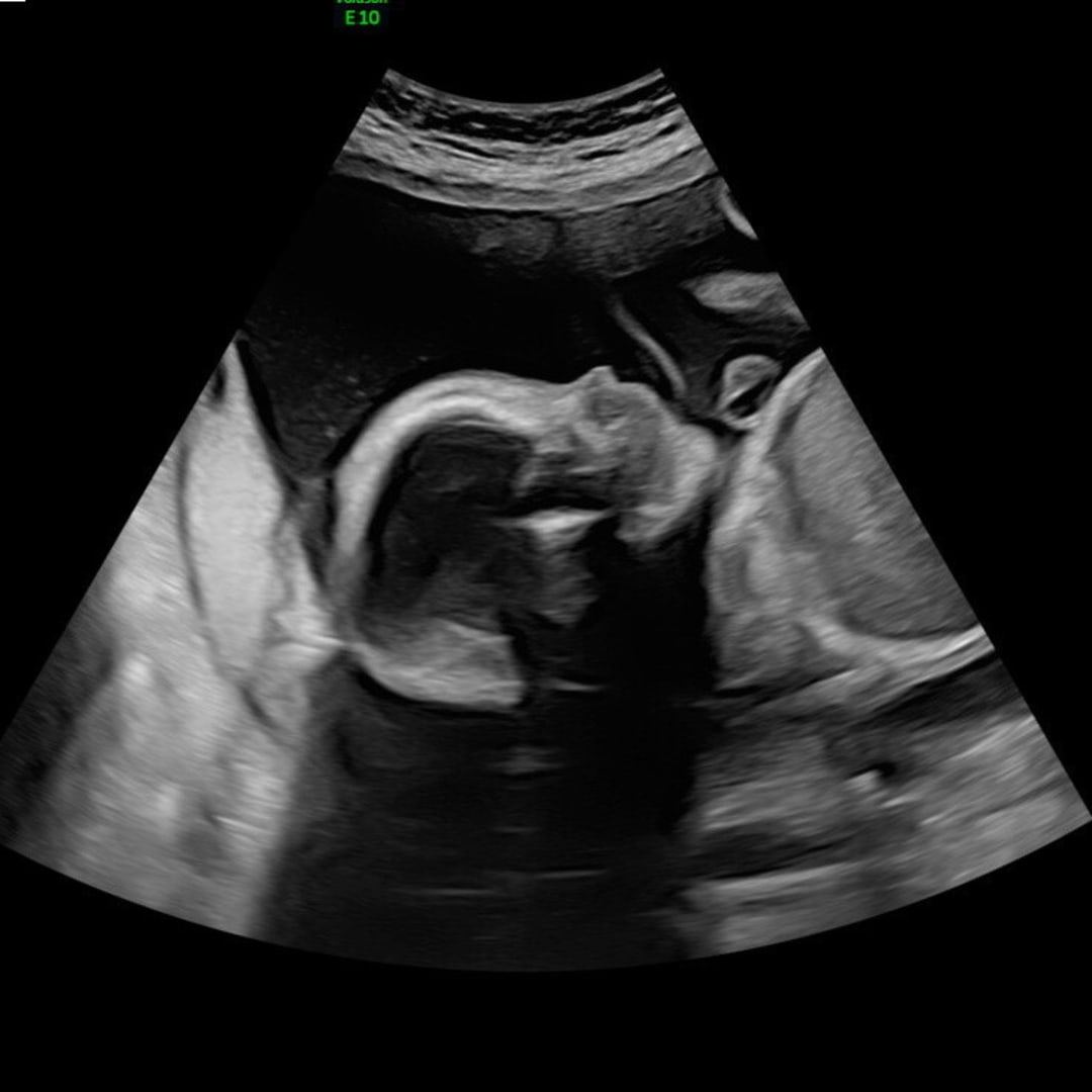 Photo shared by Ciara for their Babylist baby registry.