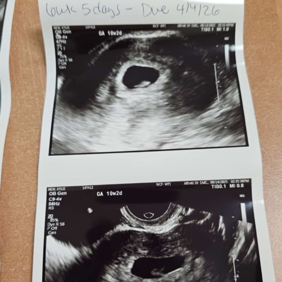 Photo shared by Kylie for their Babylist baby registry.