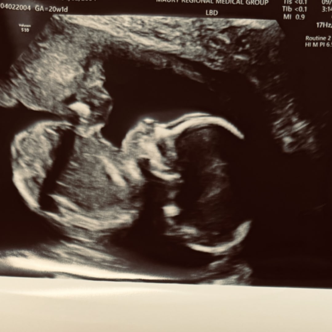 Photo shared by Lexi for their Babylist baby registry.