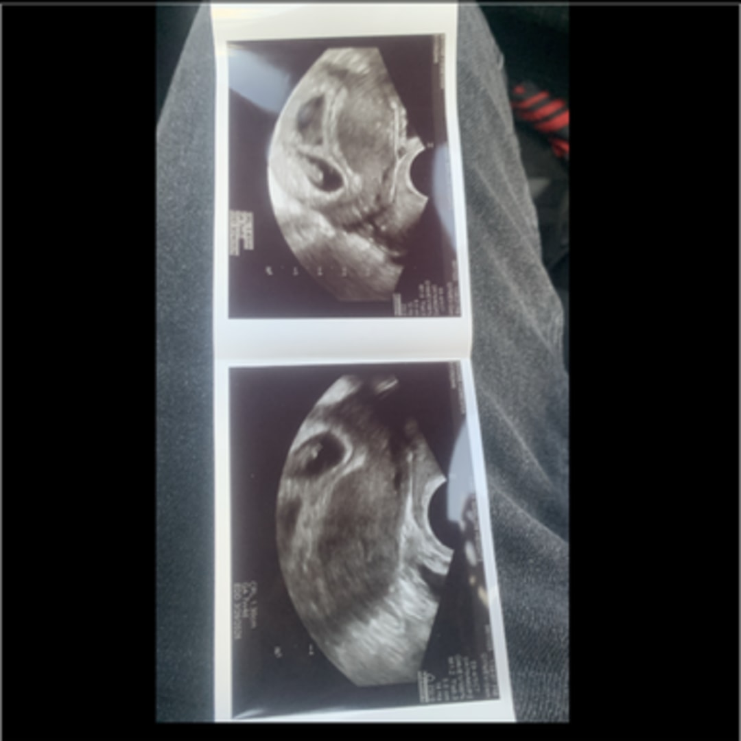 Photo shared by Kemeshia for their Babylist baby registry.
