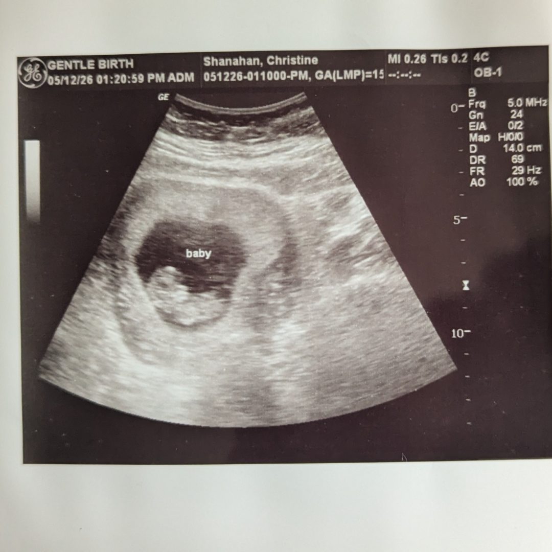 Photo shared by Christine for their Babylist baby registry.