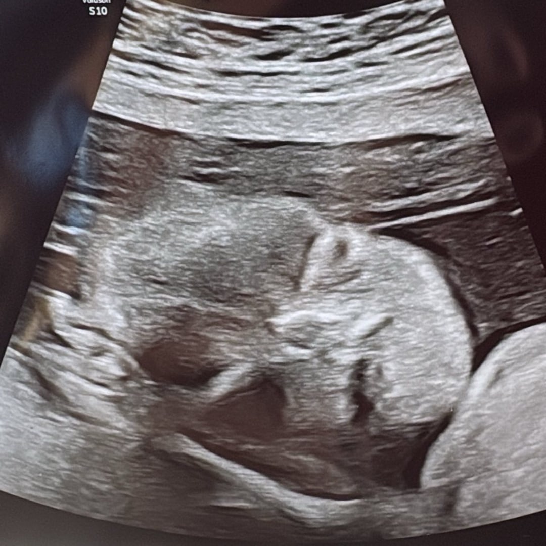 Photo shared by Cristina for their Babylist baby registry.