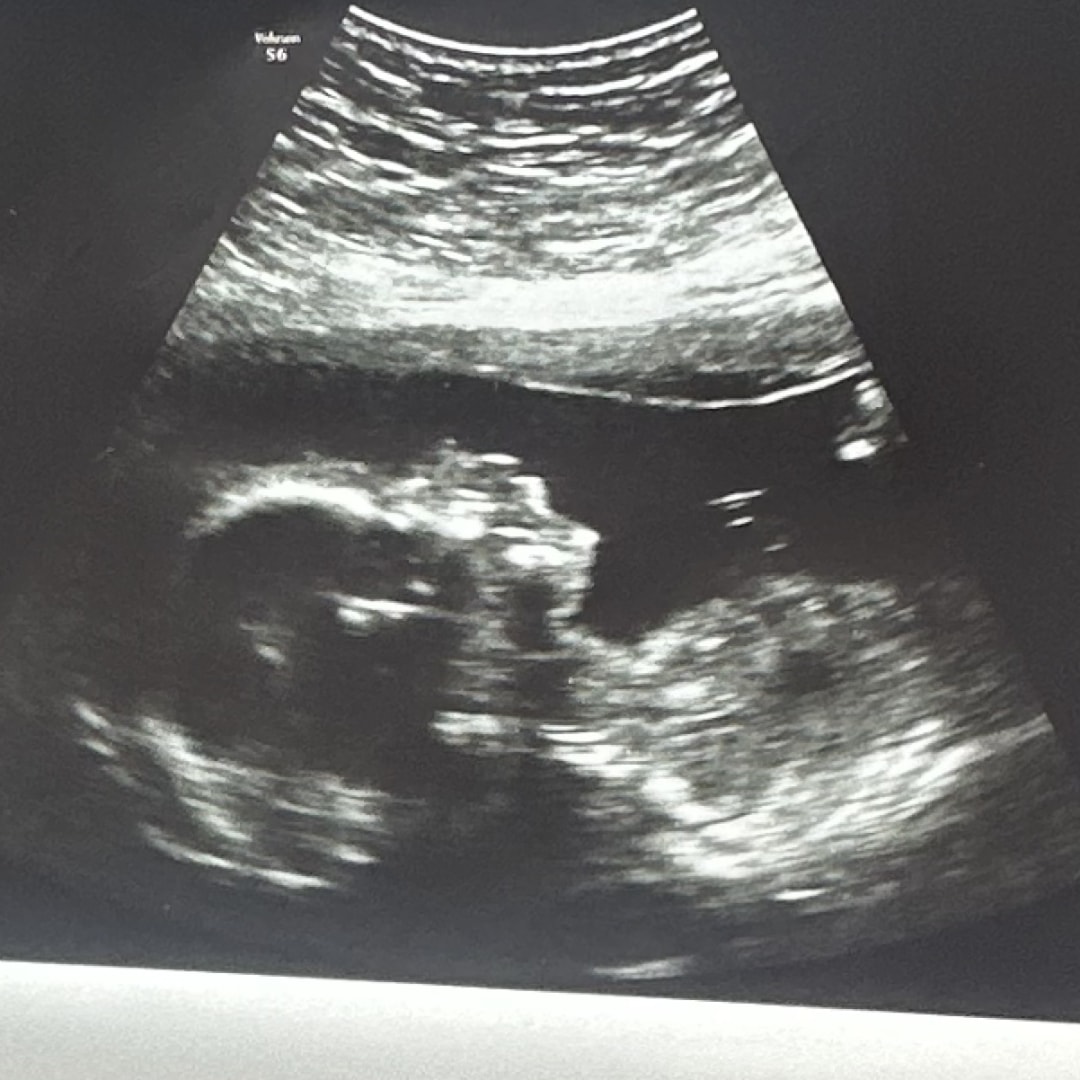 Photo shared by Alayla for their Babylist baby registry.