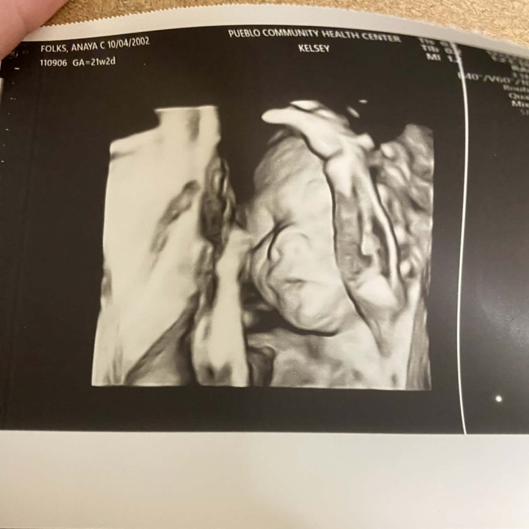 Photo shared by Anaya for their Babylist baby registry.