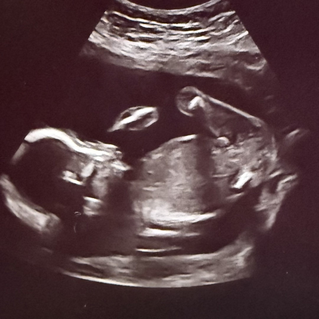 Photo shared by Baylee for their Babylist baby registry.