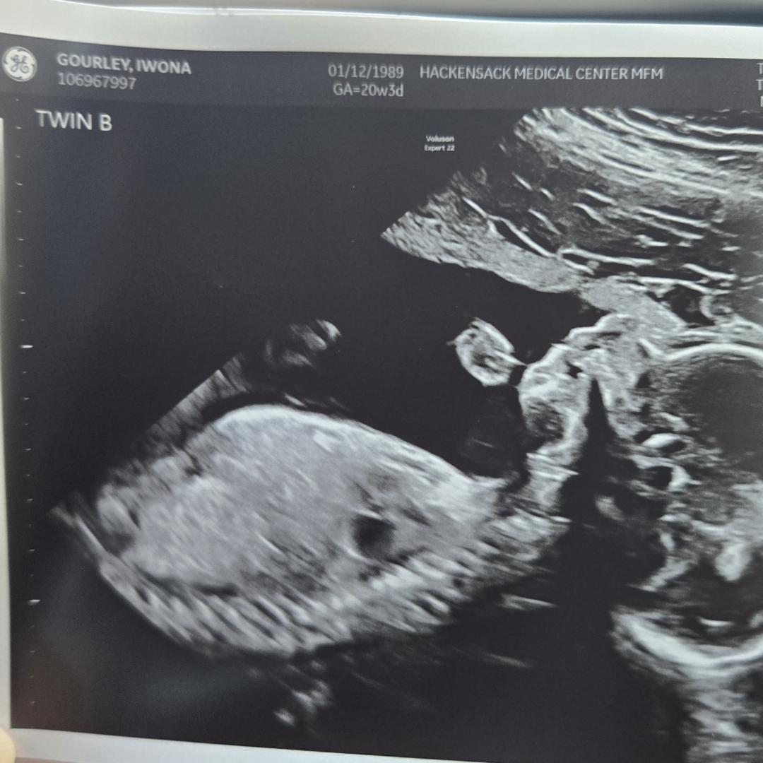 Photo shared by Ivy for their Babylist baby registry.