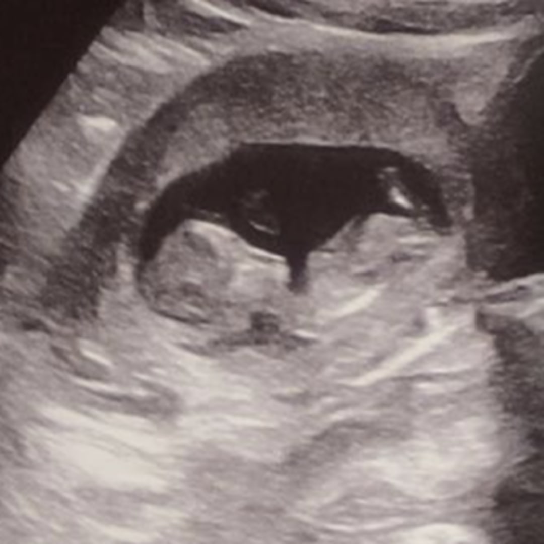 Photo shared by Titanna for their Babylist baby registry.