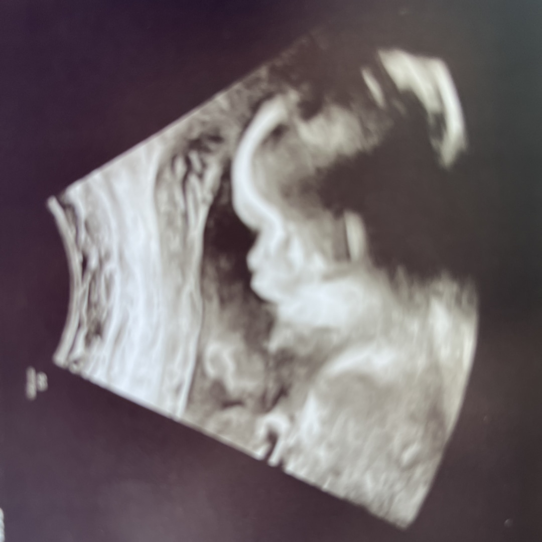 Photo shared by Jazzlyn for their Babylist baby registry.