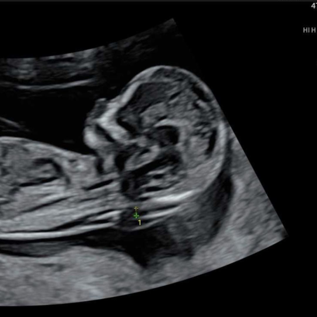 Photo shared by Alyssa for their Babylist baby registry.