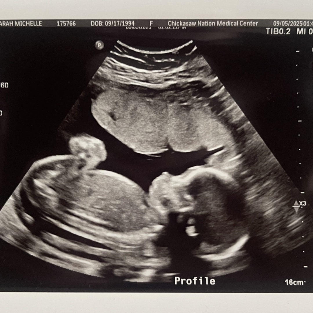 Photo shared by Sarah for their Babylist baby registry.