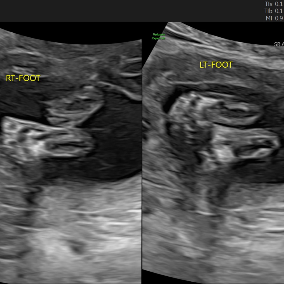 Photo shared by Jenna for their Babylist baby registry.