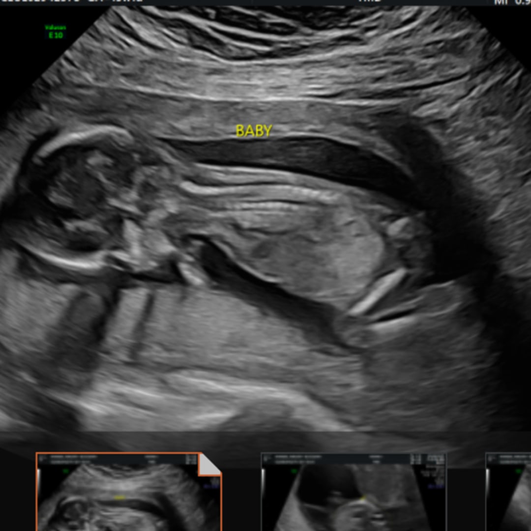 Photo shared by Malory for their Babylist baby registry.