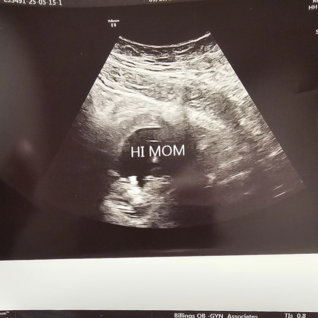 Photo shared by Jorion for their Babylist baby registry.