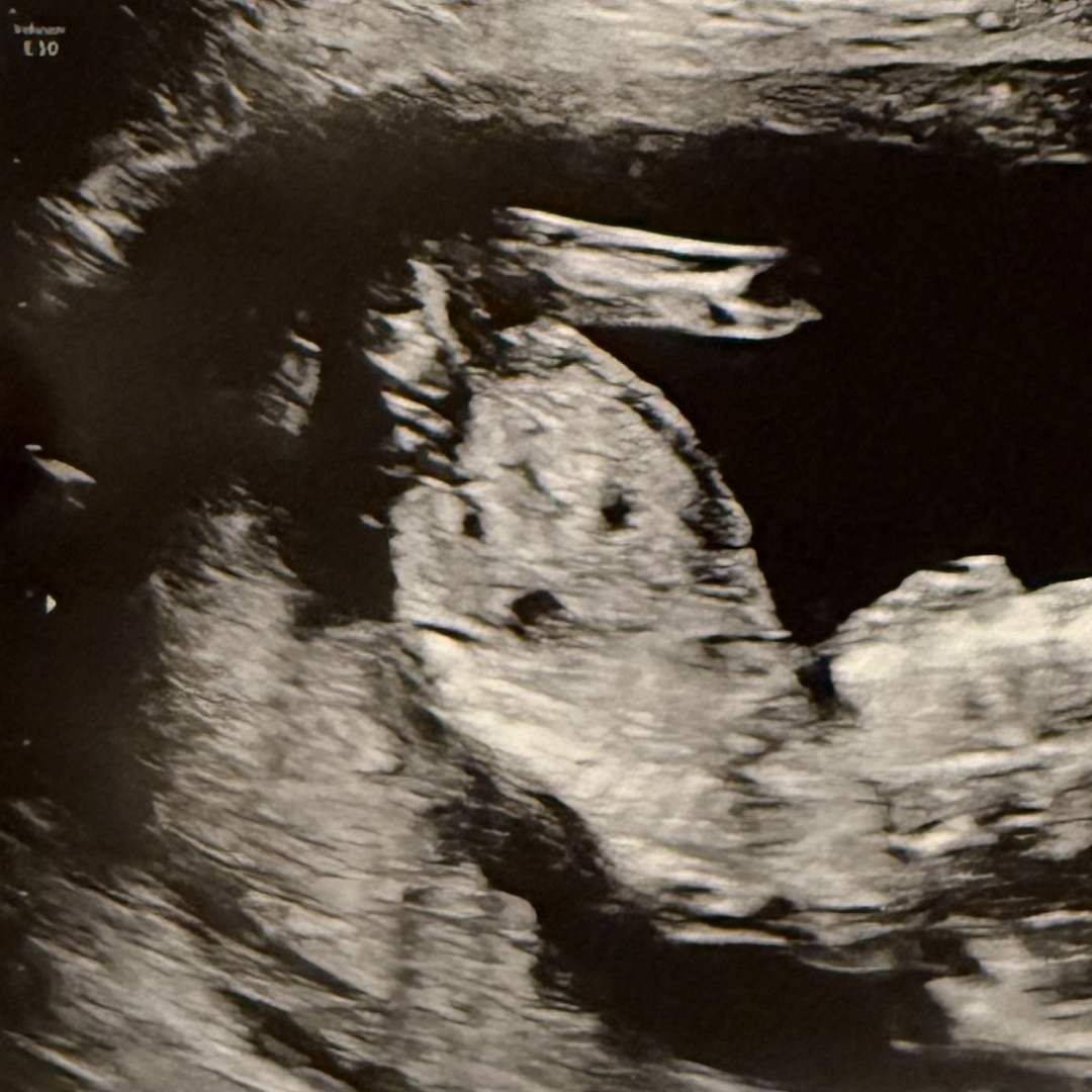 Photo shared by Lola for their Babylist baby registry.