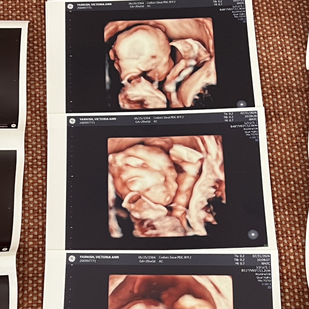 Photo shared by Victoria for their Babylist baby registry.