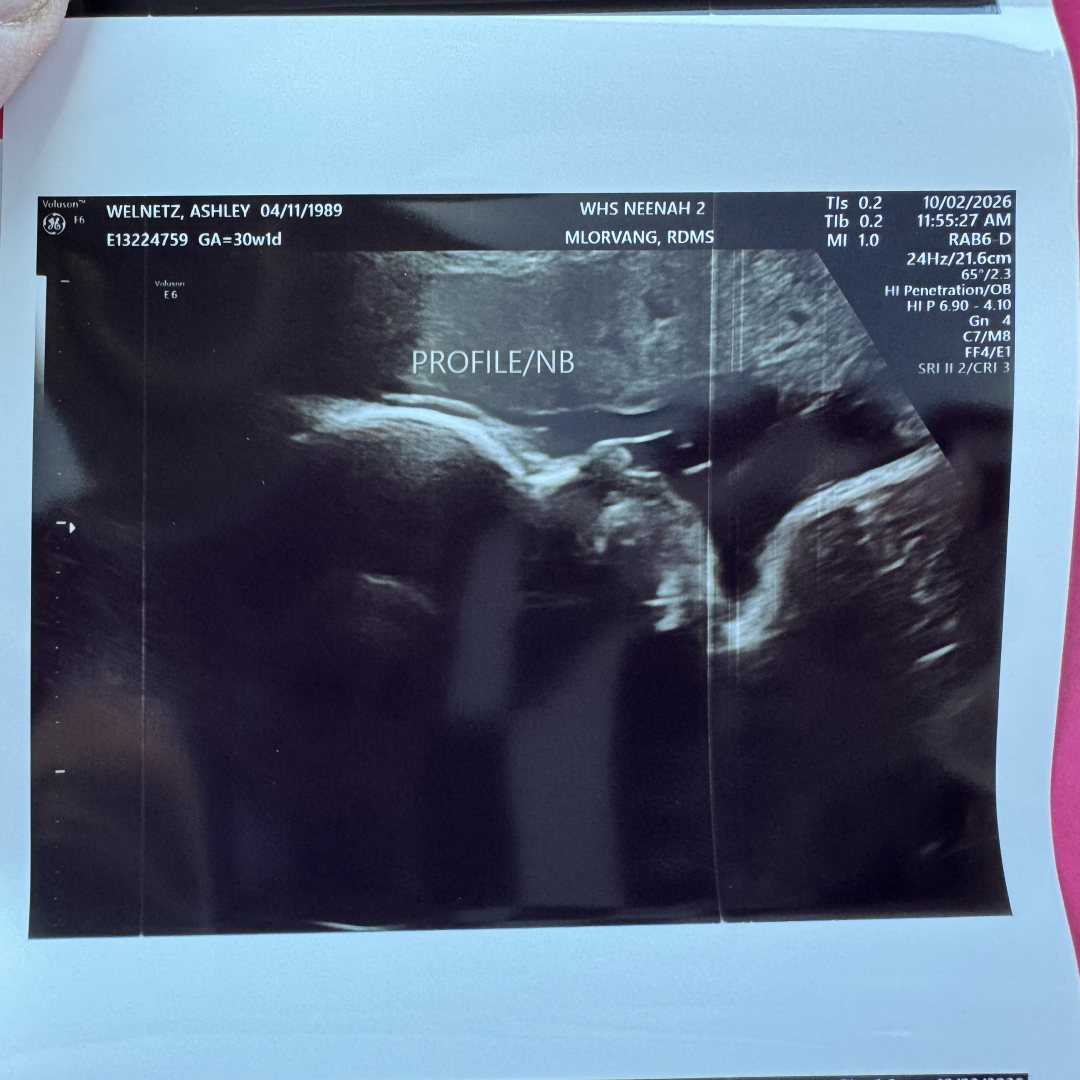 Photo shared by Ashley for their Babylist baby registry.