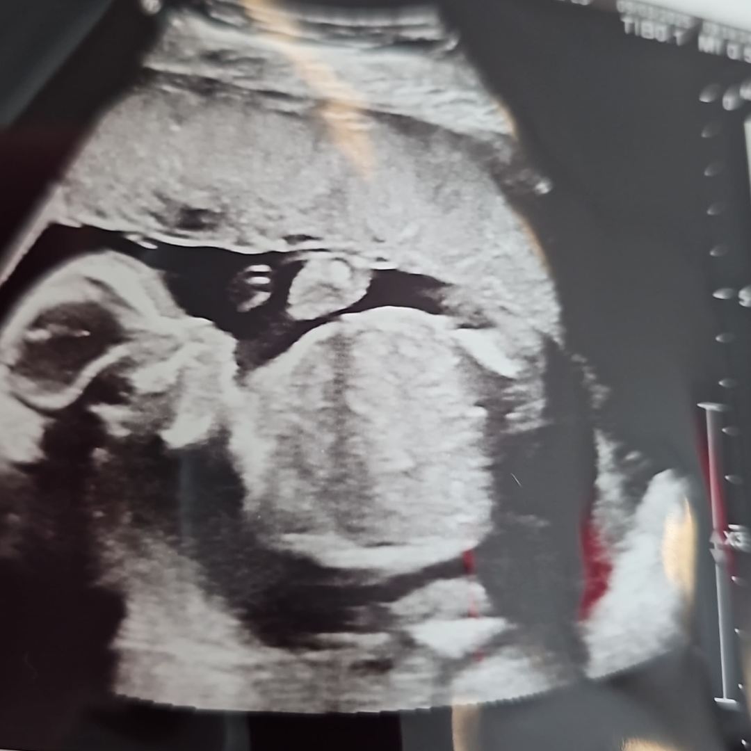 Photo shared by Breanna for their Babylist baby registry.