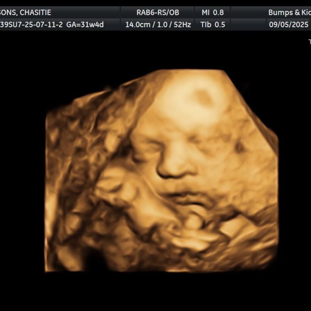 Photo shared by Chasitie for their Babylist baby registry.