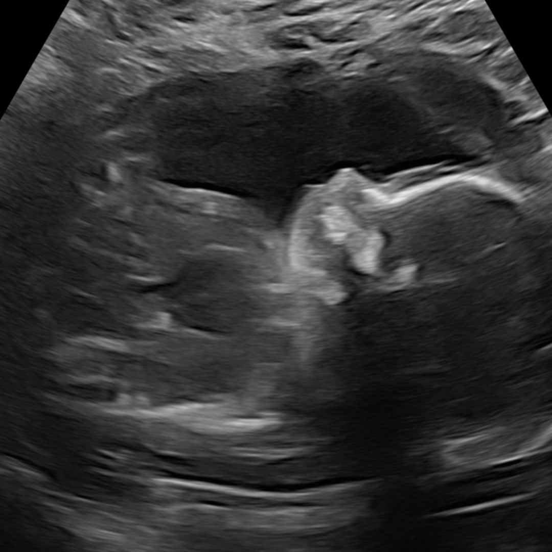 Photo shared by Emily for their Babylist baby registry.