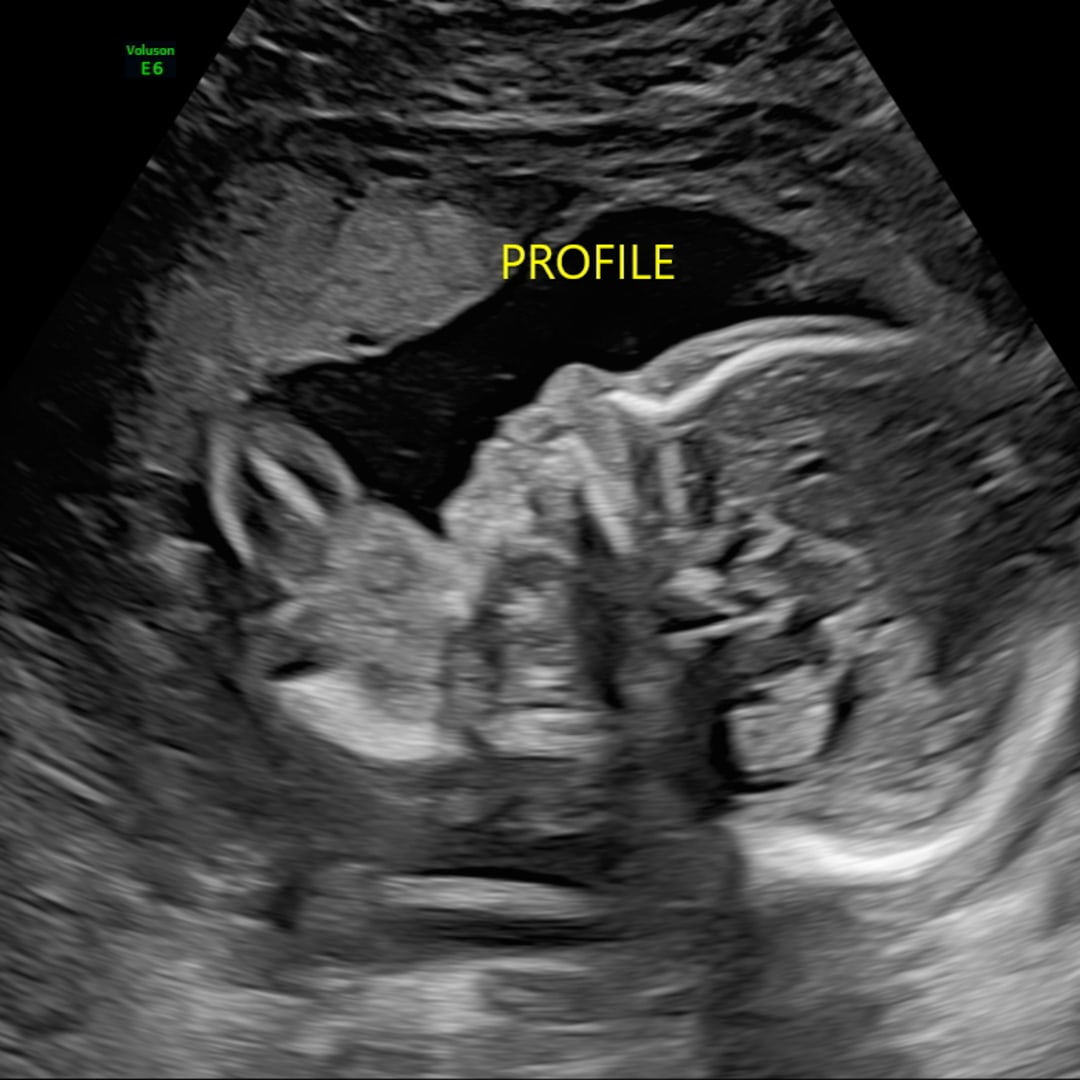 Photo shared by Coy for their Babylist baby registry.
