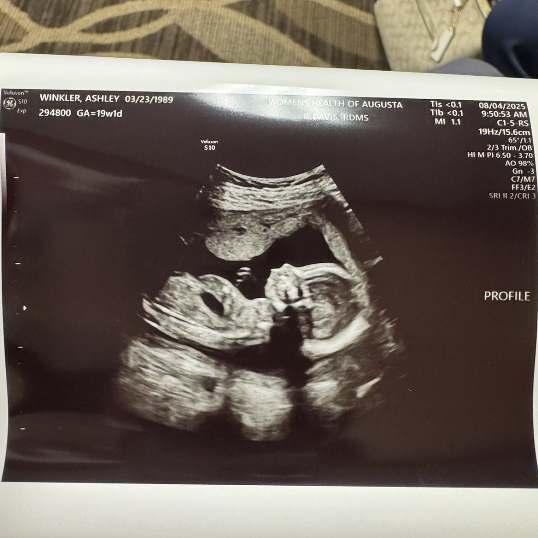 Photo shared by Ashley for their Babylist baby registry.