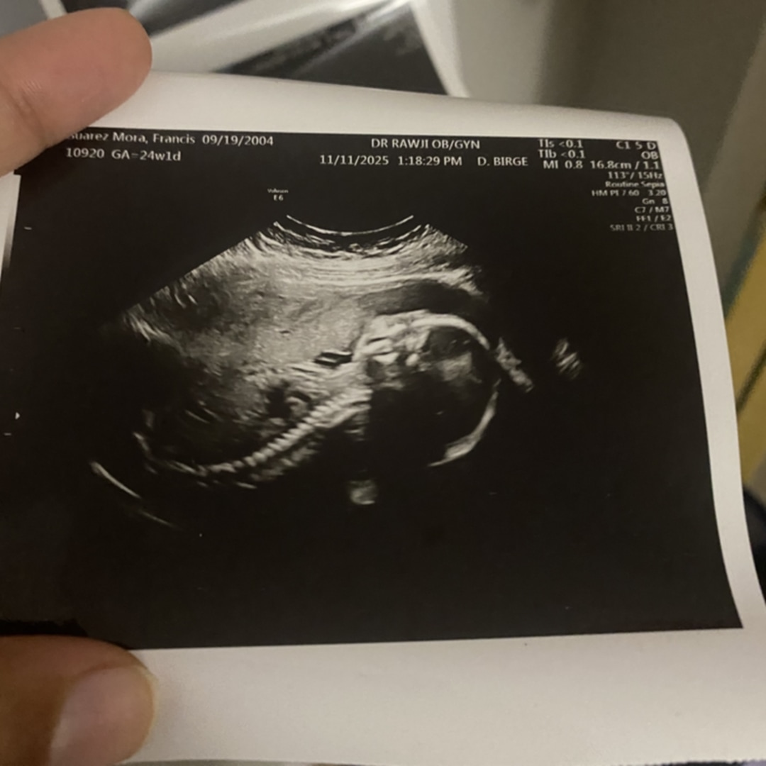 Photo shared by Betzabe for their Babylist baby registry.