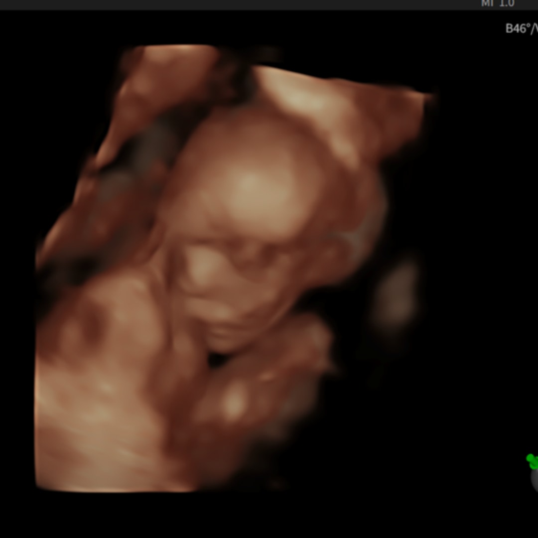 Photo shared by Kat for their Babylist baby registry.