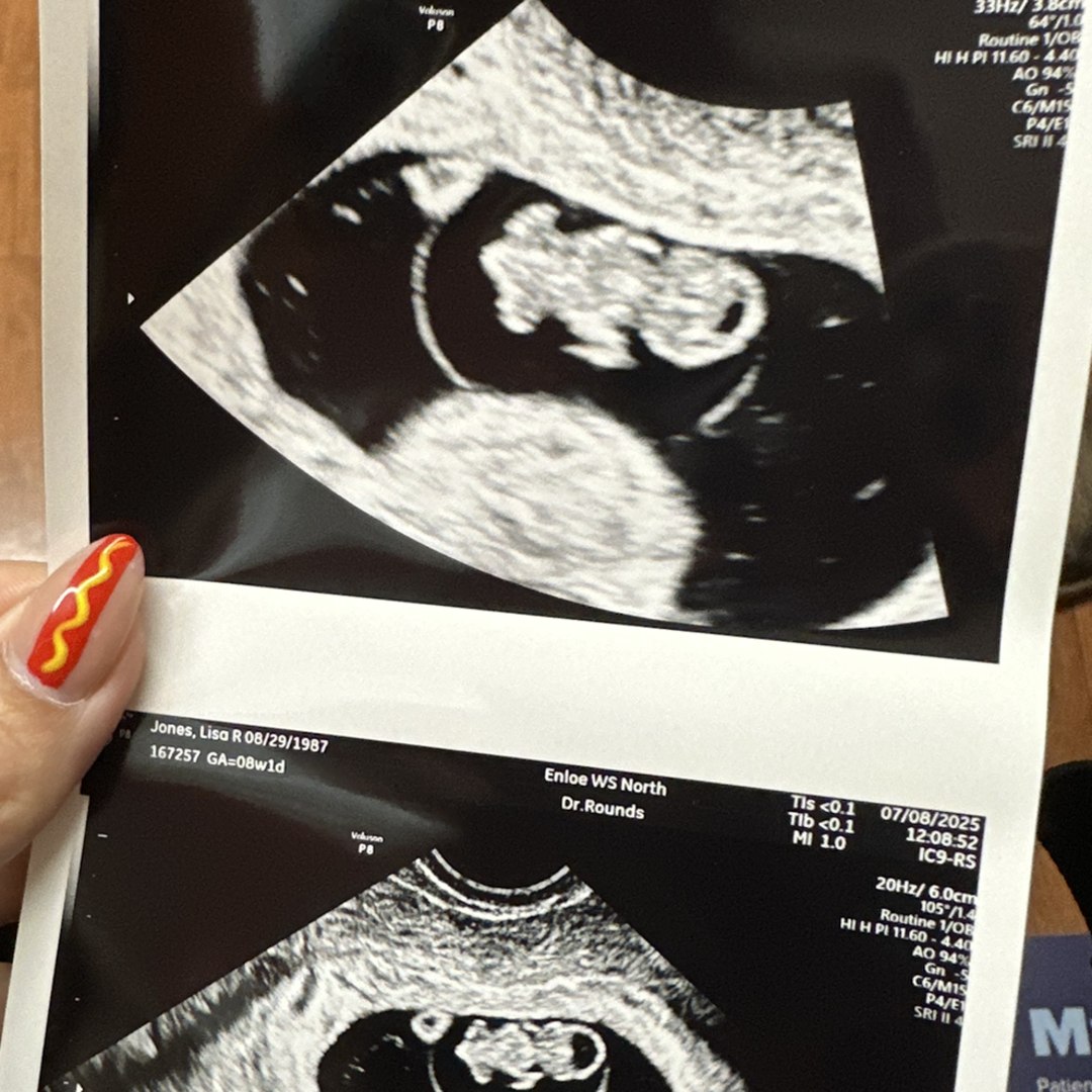 Photo shared by Lisa for their Babylist baby registry.