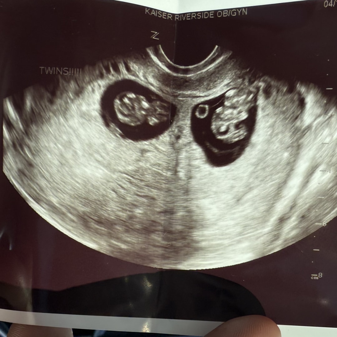 Photo shared by Joi for their Babylist baby registry.